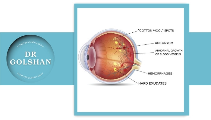 روش‌های تشخیص