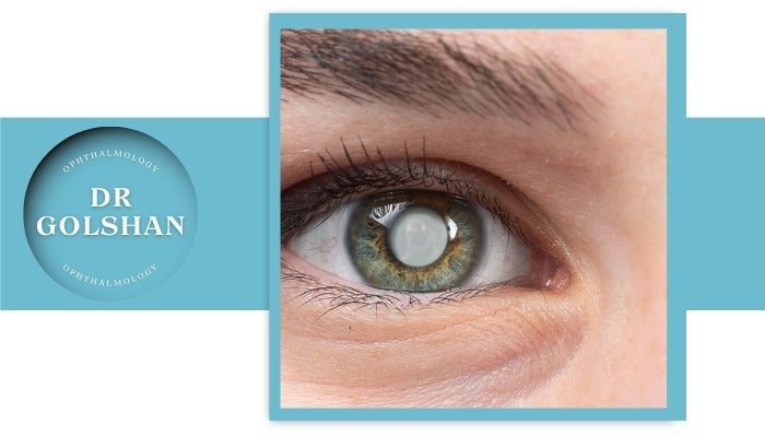 آب مروارید در جوانی