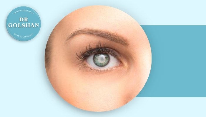 آیا آب مروارید در سنین جوانی هم ممکن است ایجاد شود؟