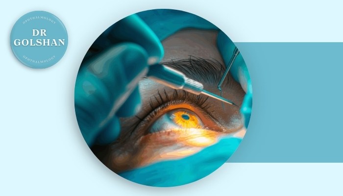 آیا عمل مجرای اشکی خطرناک است و چه مراقبت هایی نیاز دارد؟ آیا عمل مجرای اشکی خطرناک است و چه مراقبت هایی نیاز دارد؟