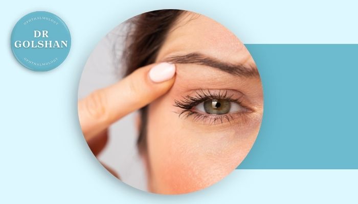 بهترین سن برای انجام بلفاروپلاستی چه زمانی است؟