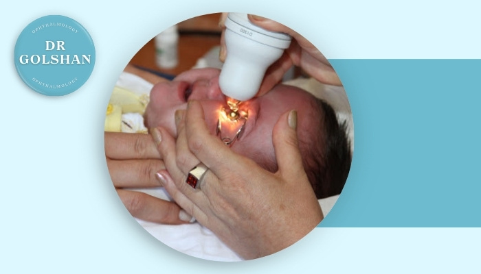 تاثیر تولد زودرس بر سلامت شبکیه چشم نوزادان، آنچه باید بدانید