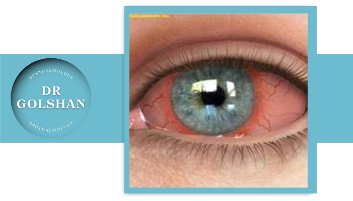 راهکار‌های پیشگیری