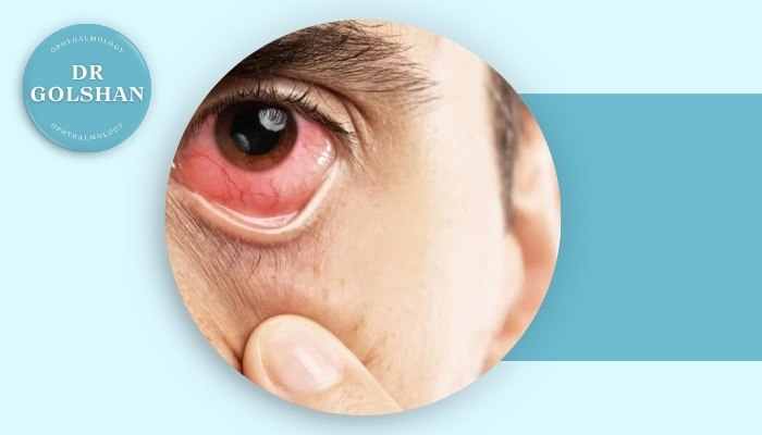 علائم هشداردهنده بیماری‌های چشمی در افراد دیابتی