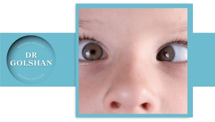 علل انحراف چشم کودک علل انحراف چشم کودک