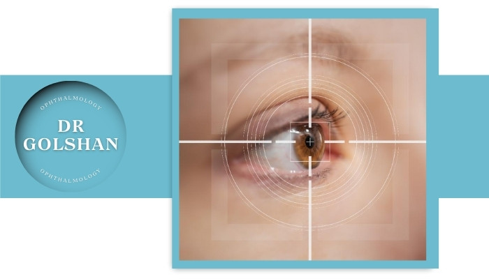 عوامل مؤثر بر برگشت نزدیک بینی بعد از لیزیک عوامل مؤثر بر برگشت نزدیک بینی بعد از لیزیک