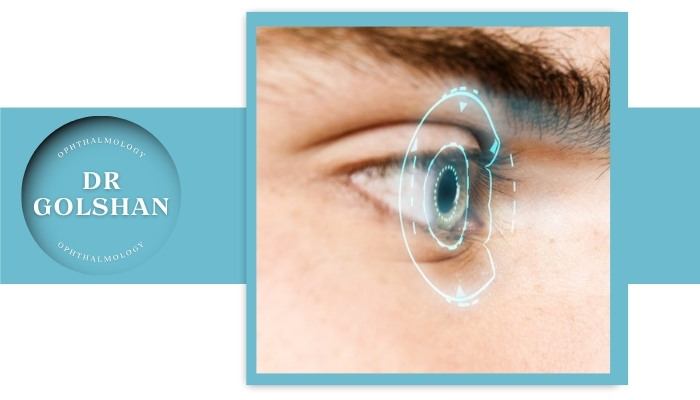 مراقبت‌های بعد از عمل لیزیک