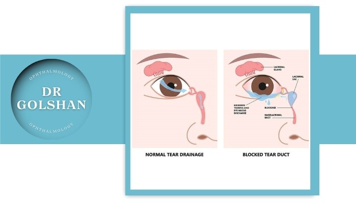 چه زمانی به جراحی نیاز داریم چه زمانی به جراحی نیاز داریم